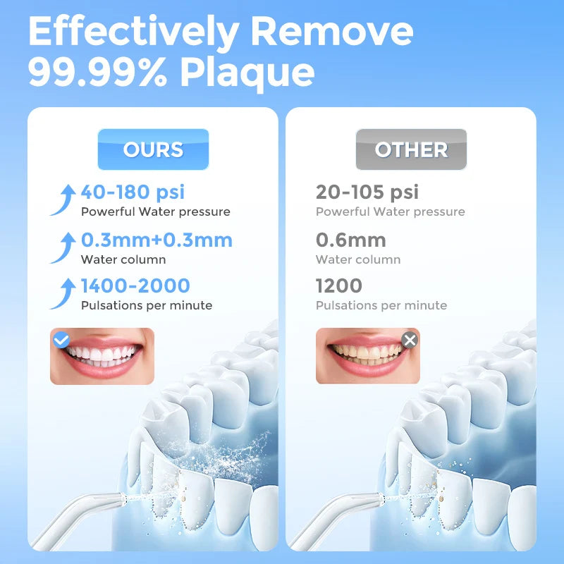 Sejoy Cordless Water Flosser For Effective Oral Cleaning
